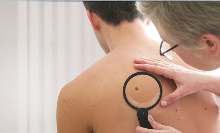 Skin Check Strathpine for Peace of Mind